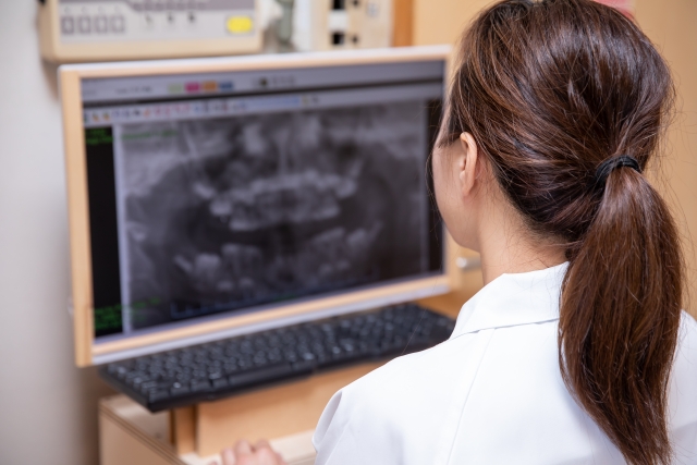 『大丈夫？』がスタッフを追い詰める？歯科医院で起きている見えない負担